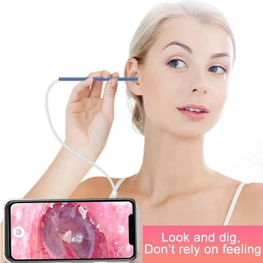 Otoscope Video HD Ear Cleaner Camera In Ear Cleaning Endoscope Spoon Mini Camera Ear Picker Ear Wax Removal Visual Ear Mouth Nos